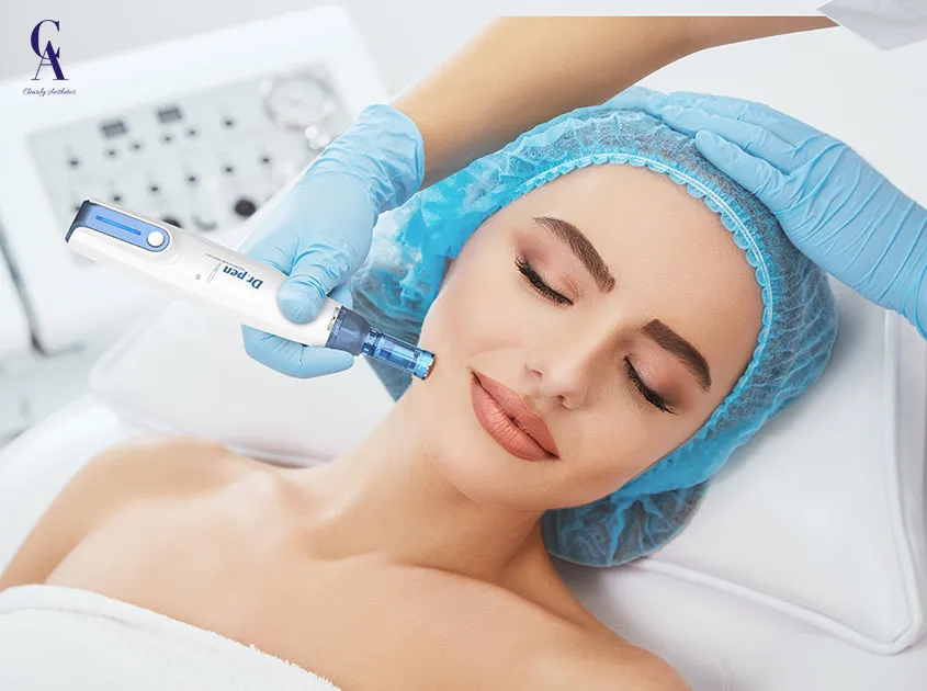 Microneedling Collagen Induction Therapy